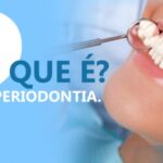 Periodontia, sabe do que se trata?