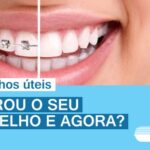 Retirou o seu aparelho dentário?